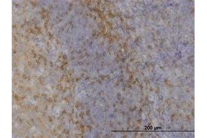 Image no. 1 for anti-Mitogen-Activated Protein Kinase 12 (MAPK12) (AA 251-368) antibody (ABIN598915) (MAPK12 antibody  (AA 251-368))