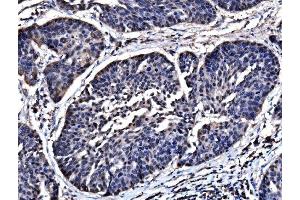 IHC analysis of HSPA6 using anti-HSPA6 antibody (ABIN7601944).