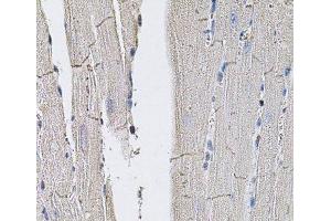 Immunohistochemistry of paraffin-embedded Mouse heart using GLUT3 Polyclonal Antibody (SLC2A3 antibody)