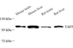 Western blot analysis of TAF5 (ABIN7075828),at dilution of 1: 800 (TAF5 antibody)