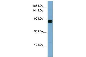 WB Suggested Anti-CASD1 Antibody Titration:  0. (CASD1 antibody  (N-Term))