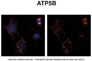 Sample Type: NT2 cellsRed: AntibodyBlue: DAPIPrimary Dilution: 1ug/50ul antibodySecondary Antibody: Alexa goat anti-rabbit 594Image Submitted by: Yuzhi Chen, University of Arkansas for Medical Sciences (ATP5B antibody  (C-Term))