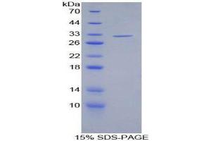 SDS-PAGE (SDS) image for S-Antigen, Retina and Pineal Gland (Arrestin) (SAG) (AA 139-388) protein (His tag) (ABIN2126701)