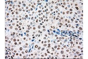 Image no. 1 for anti-TYRO3 Protein Tyrosine Kinase (TYRO3) antibody (ABIN1501605) (TYRO3 antibody)