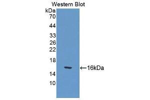 Western blot analysis of the recombinant protein. (CUBN antibody  (AA 98-207))
