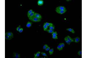 Immunofluorescence staining of HepG2 cells with ABIN7165300 at 1:133, counter-stained with DAPI. (DOK7 antibody  (AA 416-504))