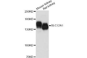 Western blot analysis of extracts of various cell lines, using SLC12A1 antibody. (SLC12A1 antibody)