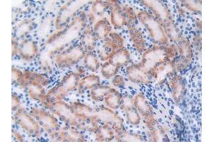DAB staining on IHC-P; Samples: Mouse Kidney Tissue (CTLA4 antibody  (AA 45-185))