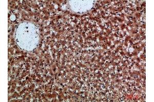 Immunohistochemical analysis of paraffin-embedded human-liver, antibody was diluted at 1:200 (CDNF antibody  (AA 31-80))