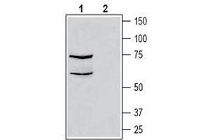 Western blot analysis of human THP-1 monocytic leukemia cell line lysate: - 1. (CALCRL antibody  (C-Term, Intracellular))