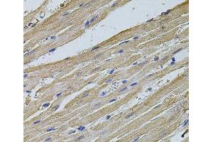 Immunohistochemistry of paraffin-embedded Rat heart using EIF4A2 Polyclonal Antibody at dilution of 1:100 (40x lens). (EIF4A2 antibody)
