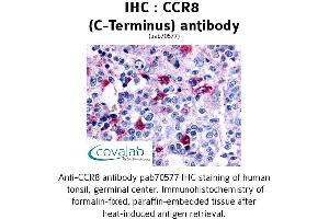 Image no. 1 for anti-Chemokine (C-C Motif) Receptor 8 (CCR8) (C-Term) antibody (ABIN1732784) (CCR8 antibody  (C-Term))