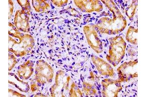 Immunohistochemistry of paraffin-embedded human kidney tissue using ABIN7152944 at dilution of 1:100 (Filamin A antibody  (AA 1234-1462))