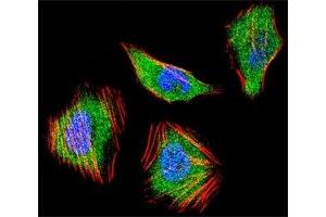 Fluorescent confocal image of HeLa cell stained with SMAD4 antibody at 1:25. (SMAD4 antibody  (AA 400-428))