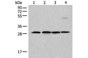 Western blot analysis of Human urinary bladder tissue Mouse heart tissue Mouse kidney tissue and RAW264.