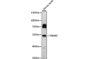 Western blot analysis of extracts of mouse testis, using TRIM60 antibody (ABIN7270995) at 1000 dilution. (TRIM60 antibody  (AA 1-300))