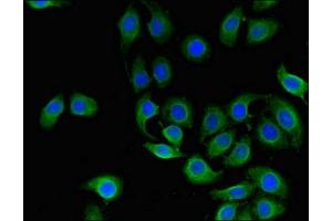 Immunofluorescent analysis of A549 cells using ABIN7147114 at dilution of 1:100 and Alexa Fluor 488-congugated AffiniPure Goat Anti-Rabbit IgG(H+L) (CD151 antibody  (AA 125-199))
