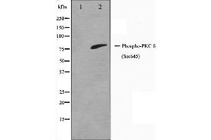 Western blot analysis of PKC delta phosphorylation expression in MCF7 whole cell lysates,The lane on the left is treated with the antigen-specific peptide.
