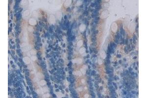 Immunohistochemistry (IHC) image for anti-ArfGAP with Dual PH Domains 2 (ADAP2) (AA 49-360) antibody (ABIN7443242)