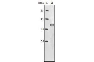 Western Blot showing IGF1R antibody used against truncated IGF1R recombinant protein. (IGF1R antibody)
