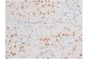 Immunohistochemistry (IHC) image for anti-Nuclear Factor-kB p65 (NFkBP65) (pSer281) antibody (ABIN6255162)