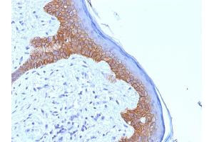 Formalin-fixed, paraffin-embedded human Skin stained with Desmoglein-3 Monoclonal Antibody (5G11). (Desmoglein 3 antibody)