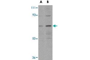 Western blot analysis of NOTUM in human kidney tissue lysate with NOTUM polyclonal antibody  at (A) 0. (NOTUM antibody  (N-Term))