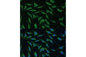 Immunofluorescence analysis of L929 cells using FB antibody (ABIN7267107) at dilution of 1:100. (FAM127B antibody  (AA 1-113))