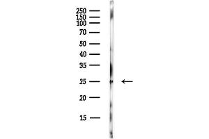 anti-Adenylate Kinase 4 (AK4) (Internal Region) antibody