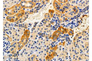 ABIN6256906 and ABIN6274857 at 1/100 staining Mouse kidney tissue by IHC-P.
