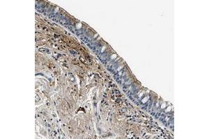 Immunohistochemical staining of human bronchus with TMEM186 polyclonal antibody  shows moderate cytoplasmic and membranous positivity in respiratory epithelial cells at 1:50-1:200 dilution. (TMEM186 antibody)