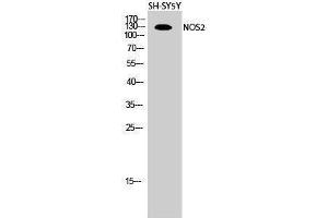 Western Blotting (WB) image for anti-Nitric Oxide Synthase 2, Inducible (NOS2) (Thr177) antibody (ABIN3176385) (NOS2 antibody  (Thr177))