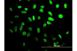 Immunofluorescence of monoclonal antibody to HES1 on HeLa cell. (HES1 antibody  (AA 36-142))