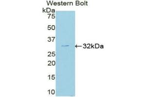 Detection of Recombinant MAPK8, Mouse using Polyclonal Antibody to c-Jun N-terminal Kinase 1 (JNK1) (C-Jun N-Terminal Kinases (AA 138-382) antibody)