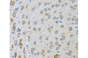 Immunohistochemistry of paraffin-embedded Rat brain using BTD Polyclonal Antibody at dilution of 1:100 (40x lens). (BTD antibody)