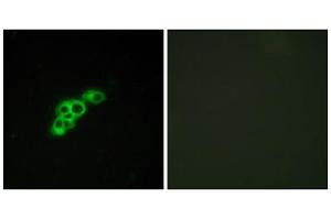 Immunofluorescence analysis of MCF-7 cells, using FSHR antibody. (FSHR antibody  (Internal Region))