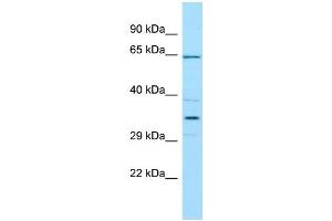 WB Suggested Anti-CFHR5 Antibody Titration: 1. (CFHR5 antibody  (N-Term))