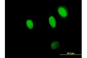 Immunofluorescence of purified MaxPab antibody to NPLOC4 on HeLa cell. (NPLOC4 antibody  (AA 1-608))