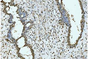 IHC analysis of EXOSC8 using anti-EXOSC8 antibody (ABIN7601850). (EXOSC8 antibody  (AA 49-216))
