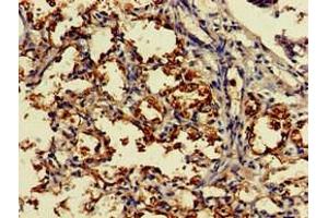 Immunohistochemistry of paraffin-embedded human lung tissue using ABIN7149454 at dilution of 1:100 (DDO antibody  (AA 37-161))