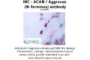Image no. 1 for anti-Aggrecan (ACAN) (N-Term) antibody (ABIN1731433)
