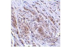 Immunohistochemistry of TRIM5 gamma in human bladder tissue with TRIM5 gamma antibody at 2 μg/ml. (TRIM5 antibody  (C-Term, Isoform gamma))
