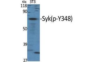 Western Blot (WB) analysis of specific cells using Phospho-Syk (Y348) Polyclonal Antibody. (SYK antibody  (pTyr348))