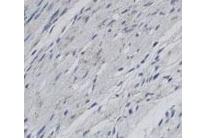 Staining of Scarb2 in rat infarctzone tissue using Scarb2 polyclonal antibody  with a DAB detection system. (SCARB2 antibody)