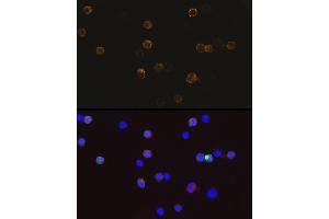 Immunofluorescence analysis of 293T-BC-Flag-GFP-C cells using Mouse anti DDDDK-Tag mAb (ABIN3020558, ABIN3020559, ABIN3020560 and ABIN1512923) at dilution of 1:100 (40x lens). (DYKDDDDK Tag antibody)