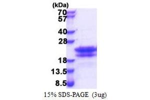 SDS-PAGE (SDS) image for Cell Cycle Exit and Neuronal Differentiation 1 (CEND1) (AA 1-125) protein (His tag) (ABIN5853459) (CEND1 Protein (AA 1-125) (His tag))