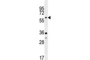 Western Blotting (WB) image for anti-Tumor Necrosis Factor Receptor Superfamily, Member 1A (TNFRSF1A) (AA 17-43) antibody (ABIN3029363)