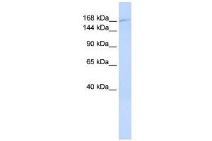 WB Suggested Anti-ZNF646 Antibody Titration:  0. (ZNF646 antibody  (N-Term))