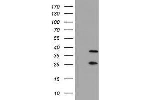 Western Blotting (WB) image for anti-Proteasome (Prosome, Macropain) Subunit, beta Type, 7 (PSMB7) (AA 58-277) antibody (ABIN1491598)