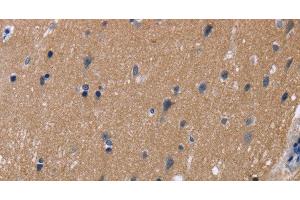 Immunohistochemistry of paraffin-embedded Human brain tissue using KCNJ11 Polyclonal Antibody at dilution 1:40 (KCNJ11 antibody)